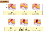 看護師のための褥瘡評価の完全ガイド|DESIGN-R評価 - しごとレトリバーガイド What To Know About Cryptocurrency Investments Before Starting