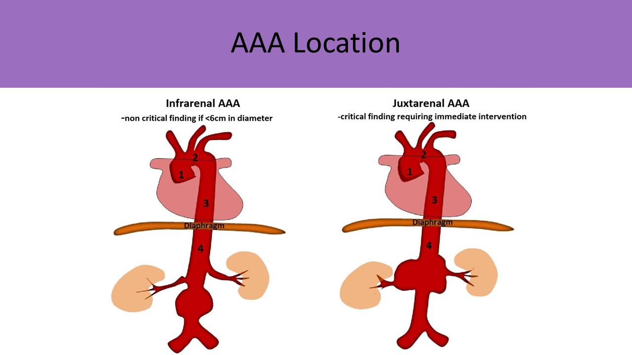 Ultrasound Registry Review - Great Vessel Anatomy How To Network Effectively In Your Industry